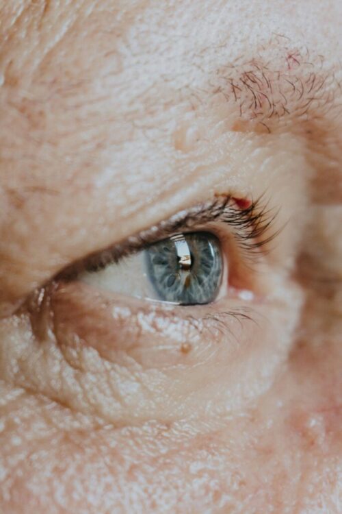 kassia-melo-YPydXJnfrE8-unsplash old person with glaucoma